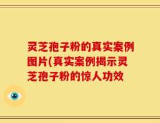 灵芝孢子粉的真实案例图片(真实案例揭示灵芝孢子粉的惊人功效