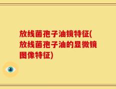 放线菌孢子油镜特征(放线菌孢子油的显微镜图像特征)