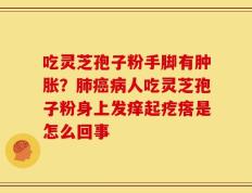 吃灵芝孢子粉手脚有肿胀？肺癌病人吃灵芝孢子粉身上发痒起疙瘩是怎么回事