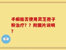 手癣能否使用灵芝孢子粉治疗？？附图片说明？
