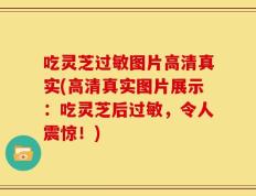 吃灵芝过敏图片高清真实(高清真实图片展示：吃灵芝后过敏，令人震惊！)