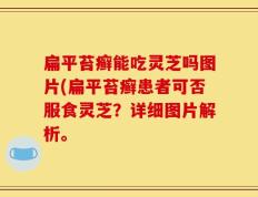 扁平苔癣能吃灵芝吗图片(扁平苔癣患者可否服食灵芝？详细图片解析。