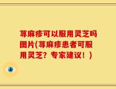 荨麻疹可以服用灵芝吗图片(荨麻疹患者可服用灵芝？专家建议！)