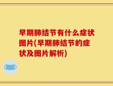 早期肺结节有什么症状图片(早期肺结节的症状及图片解析)