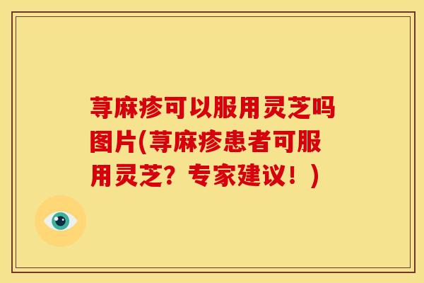 荨麻疹可以服用灵芝吗图片(荨麻疹患者可服用灵芝?专家建议!)